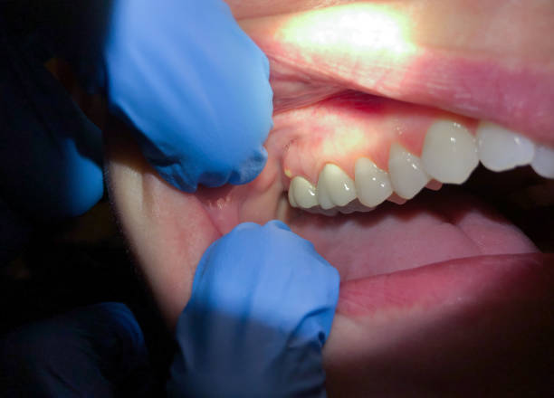 Best Emergency TMJ Treatment in Natalbany, LA