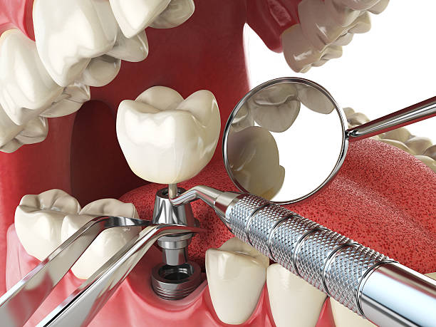 Fast & Reliable Emergency Dental Services in LA